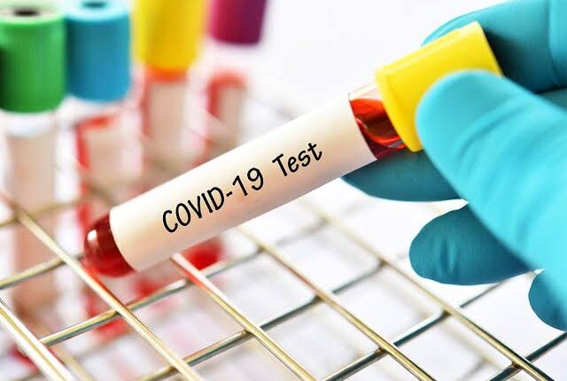 uttar-pradesh-lifts-night-curfew-as-covid-cases-decline